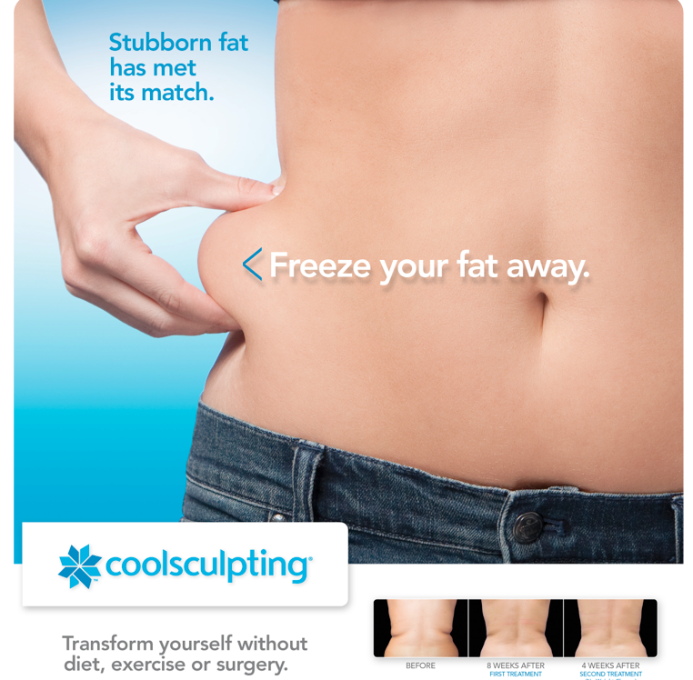 Trouble Spots? Consider CoolSculpting when diet and exercise fail