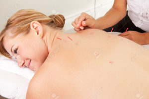 10700498-female-acupuncturist-stimulating-needles-in-the-back-shu-acupuncture-points300x200