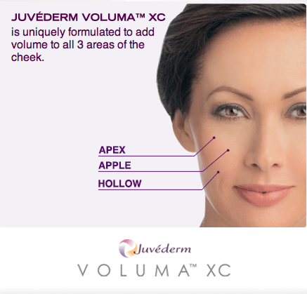 Facial Rejuvenation With Juvederm