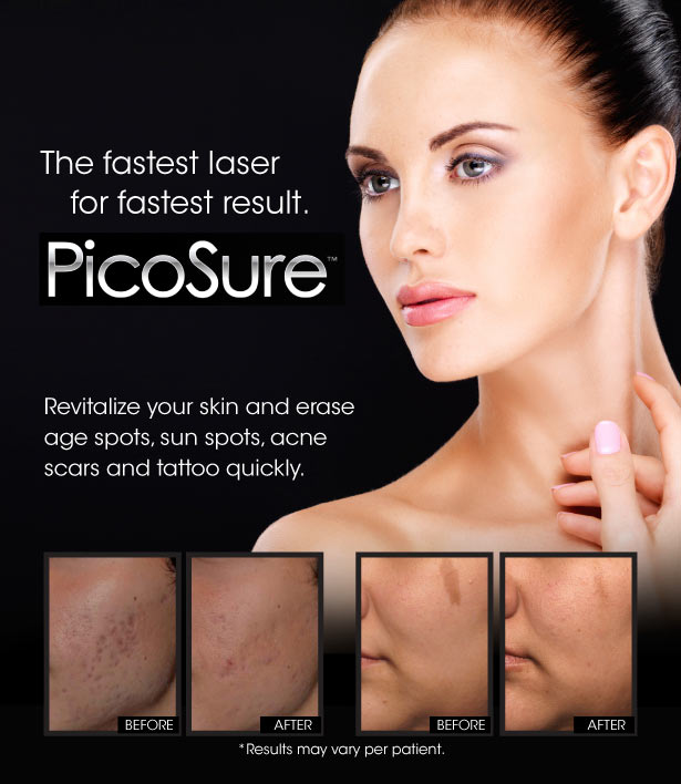 Picosure and Scars