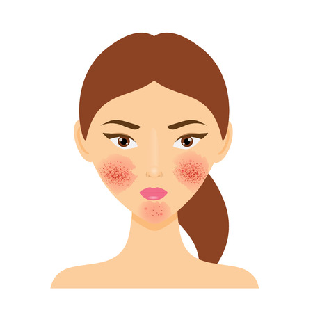 Treat Rosacea with Laser Genesis!