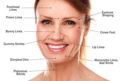 Can Botox Help Dimpled Chins & Marionette Lines?