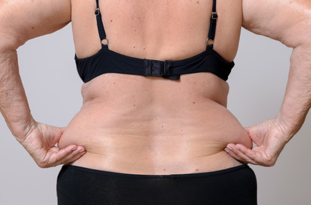 How Can You Maximize Coolsculpting Results