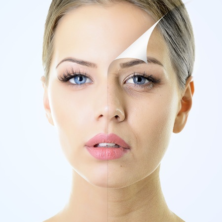 What is Sculptra Aesthetic?