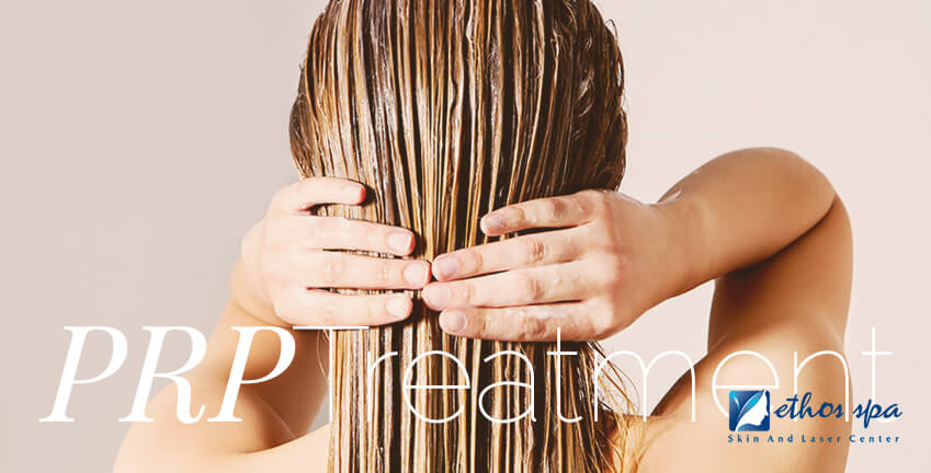 PRP Treatment for Scalp